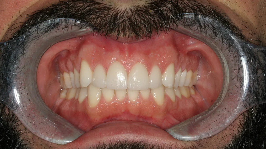 After dental treatment at Metropolitan Dental Centre, case 02