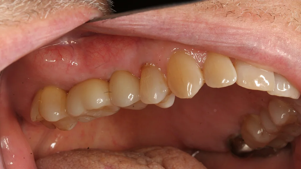 After dental treatment at Metropolitan Dental Centre, case 04