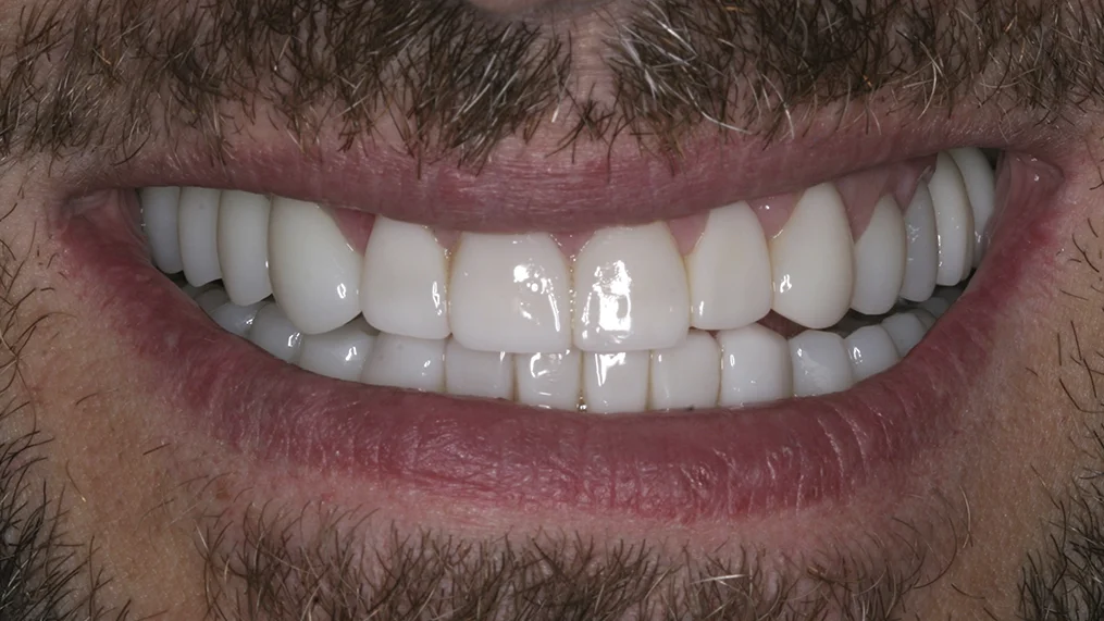 After — Metropolitan Dental Centre case 05