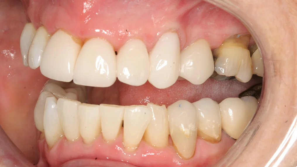 After dental treatment at Metropolitan Dental Centre, case 07