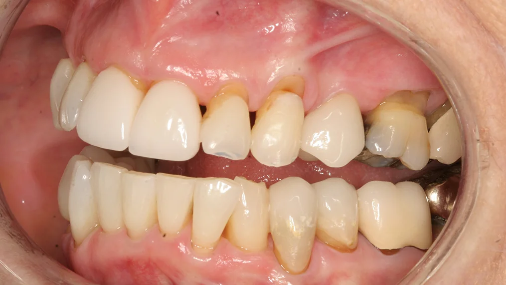 Before dental treatment at Metropolitan Dental Centre, case 07