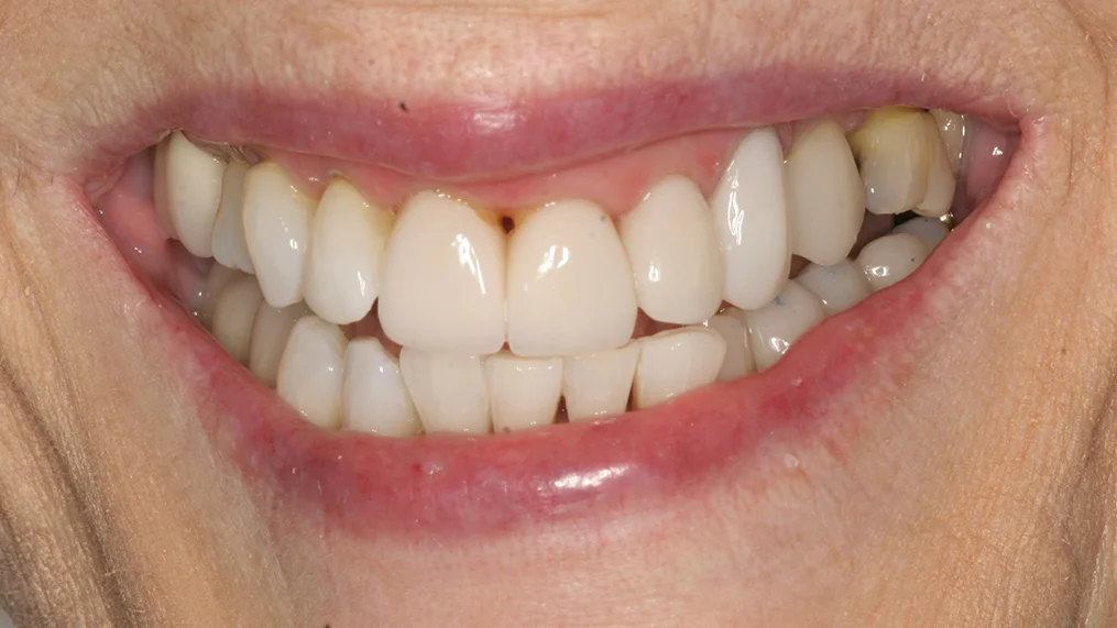 After — Metropolitan Dental Centre case 07