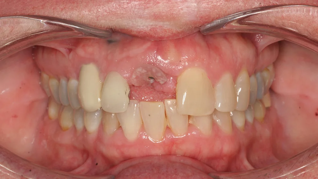 Before dental treatment at Metropolitan Dental Centre, case 08