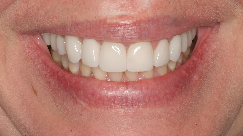After — Metropolitan Dental Centre case 08