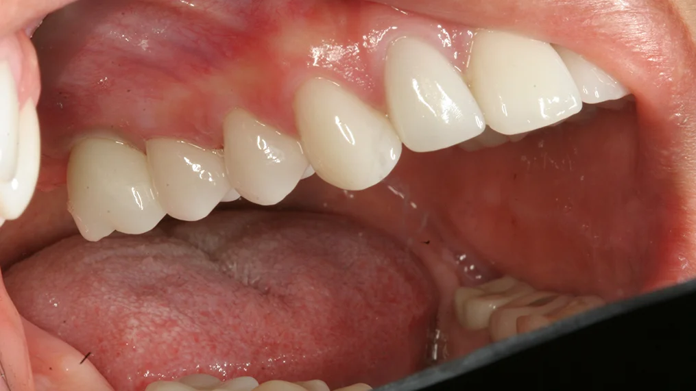 After dental treatment at Metropolitan Dental Centre, case 09