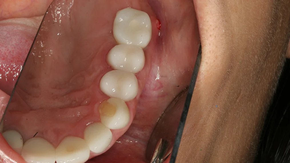 After — Metropolitan Dental Centre case 09