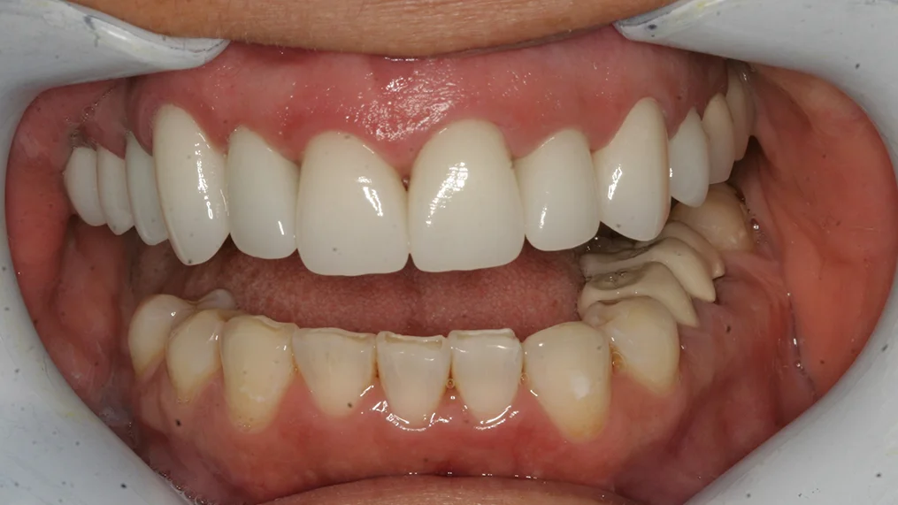 After dental treatment at Metropolitan Dental Centre, case 10