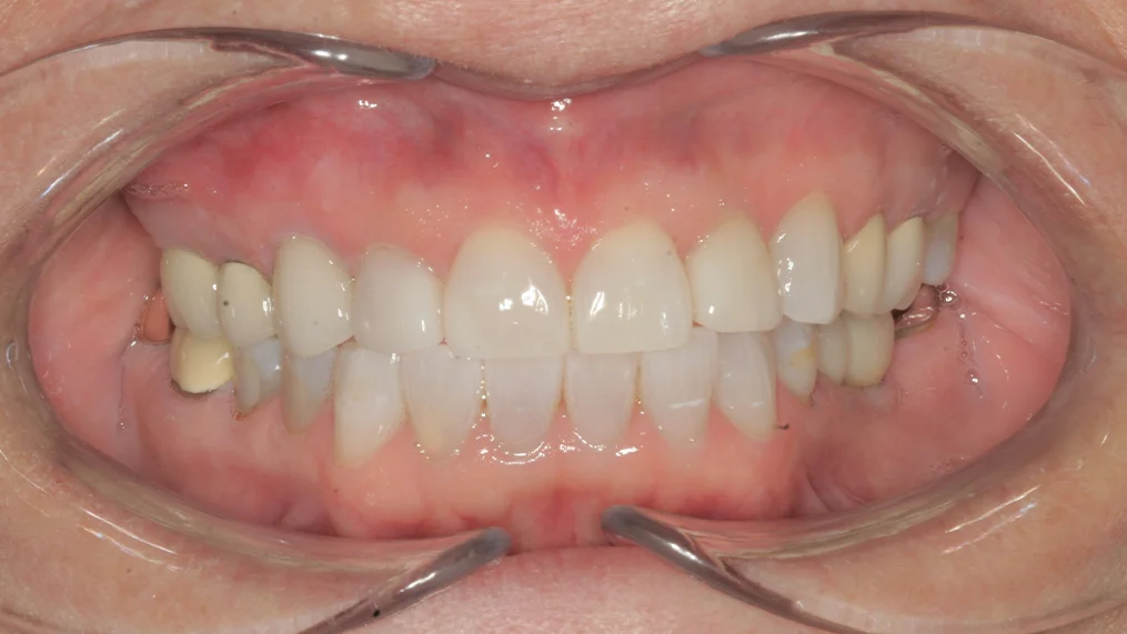 After dental treatment at Metropolitan Dental Centre, case 12
