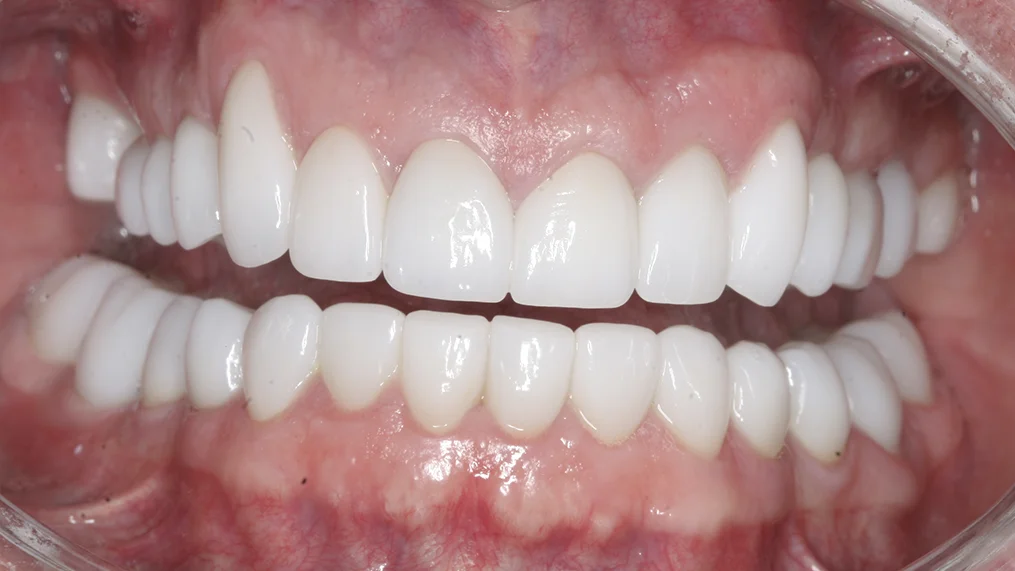 After dental treatment at Metropolitan Dental Centre, case 16