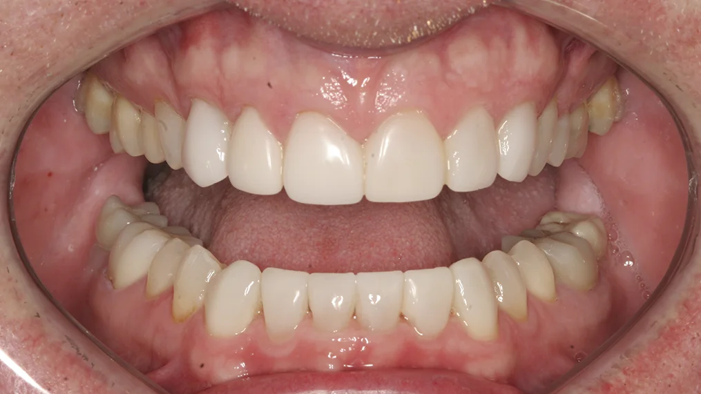 After dental treatment at Metropolitan Dental Centre, case 18