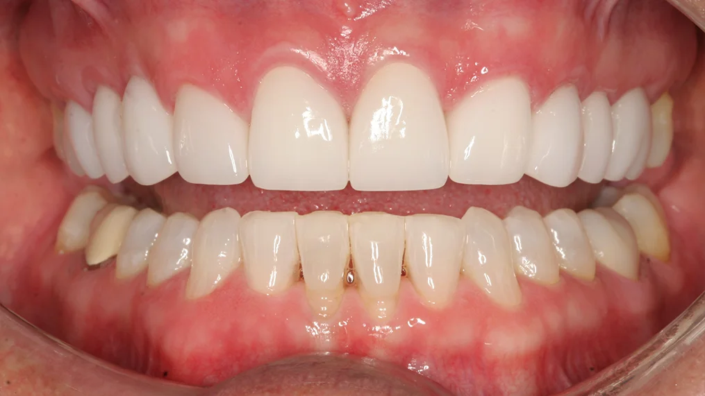 After dental treatment at Metropolitan Dental Centre, case 19